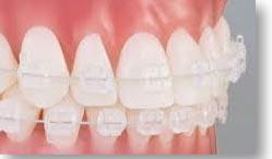 A Review On Fixed and Removable Dentures