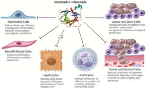 UTI Dyer and the Role of Interleukin